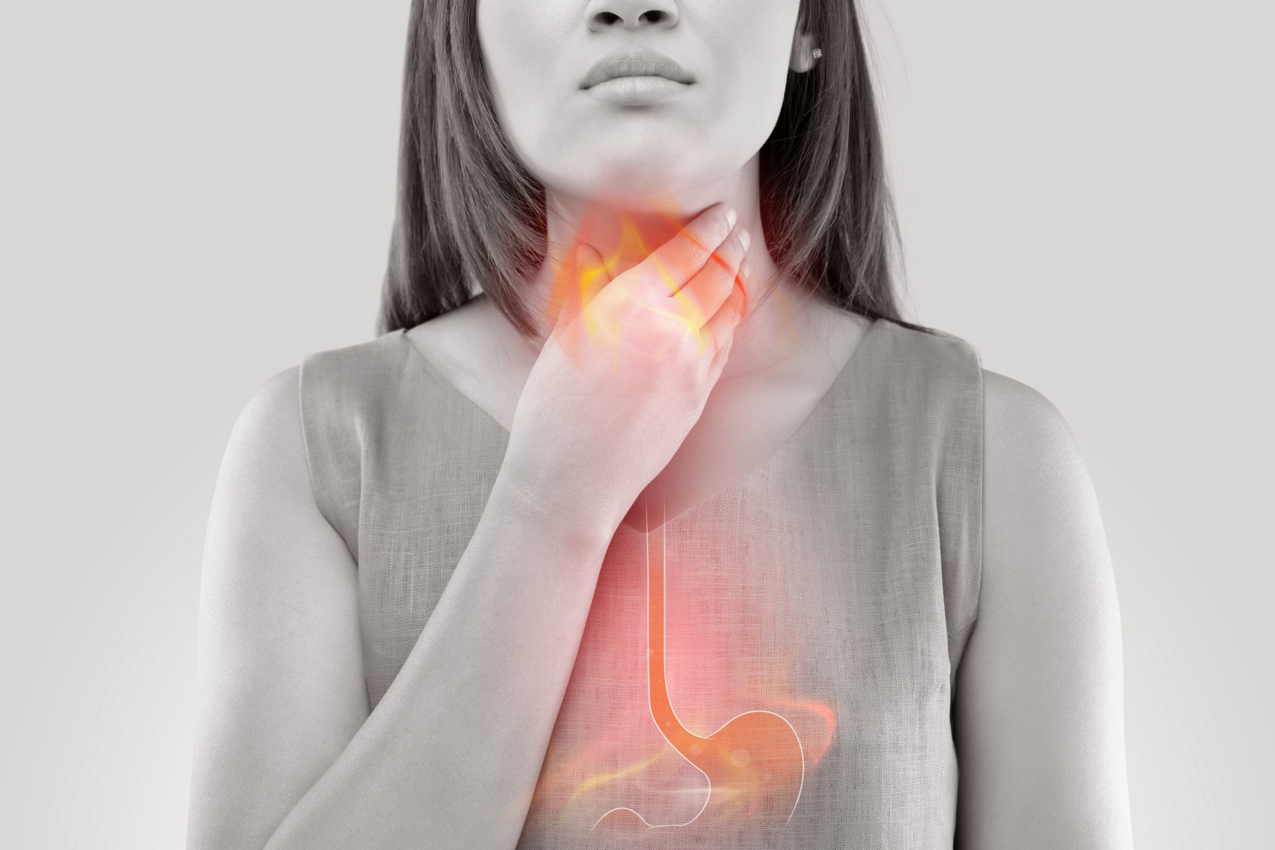 Malattia da reflusso gastro-esofageo e terapia manuale osteopatica