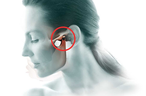 Cefalea da disordine Temporo-Mandibolare e terapia manuale Osteopatica